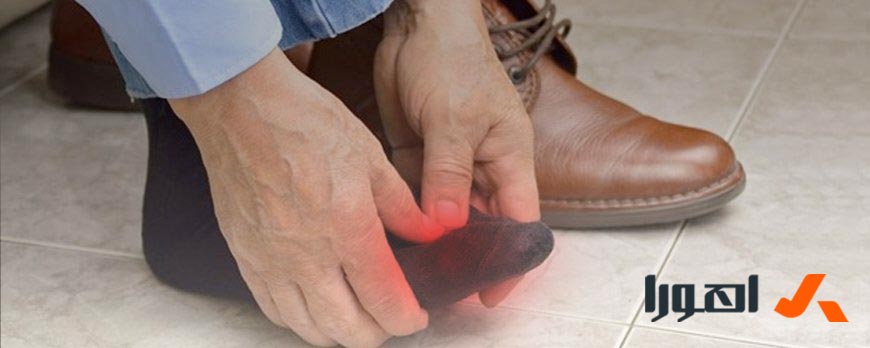 راهکارهای ساده از درد و زدگی پا در کفش‌ها جلوگیری کنید