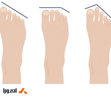 کفش مناسب برای فرم پای خود انتخاب کنید